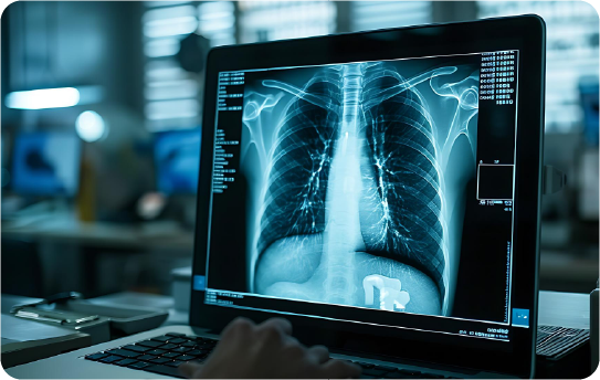 Digital X-Rays